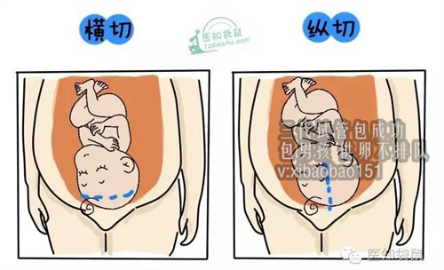 ivf试管助孕婴儿,了解上海试管价格表，确定具体价格定位！